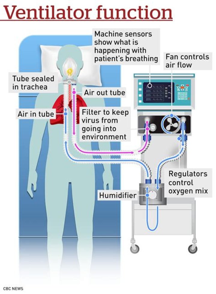 What is the difference between a ventilator and intubation